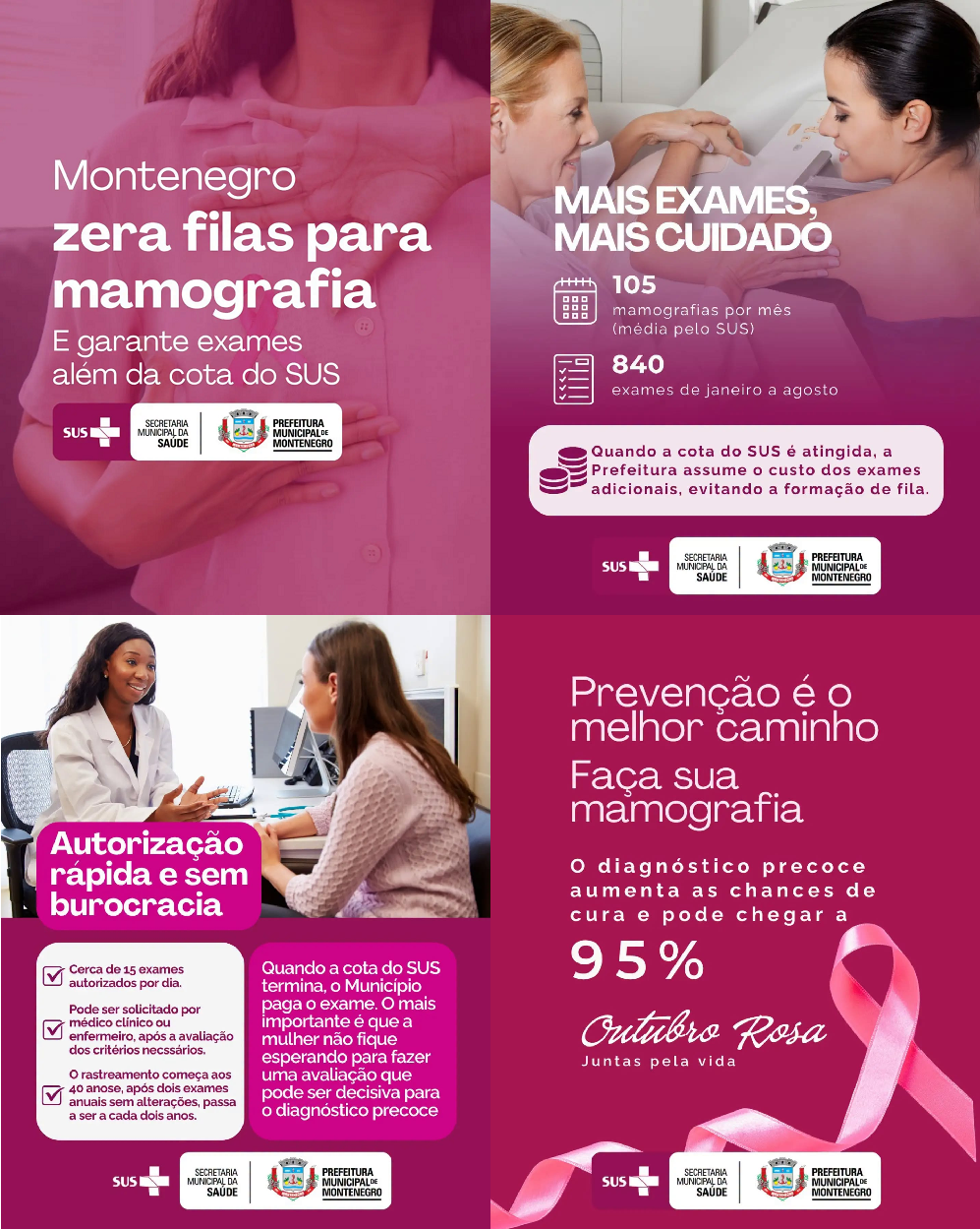 Montenegro zera fila de mamografias e garante exames além da cota do SUS